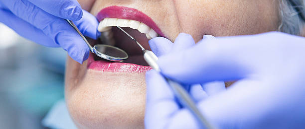 Best Emergency Dentist for Lost Fillings or Crowns in Wood Village, OR